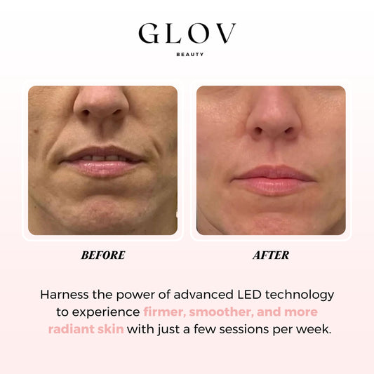 Glov Beauty LED mask user reading during therapy