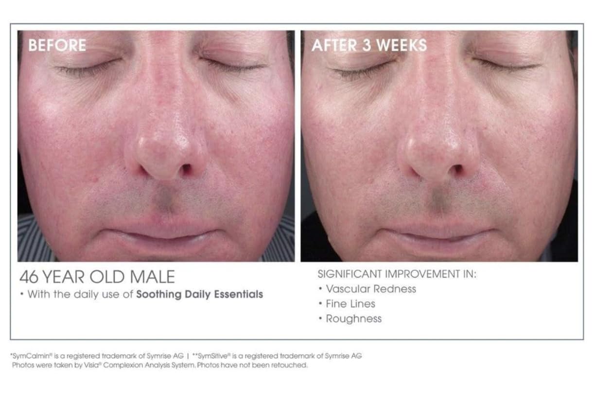 Glowbiotics Calming Restorative Treatment after-application glow indicating calmer complexion
