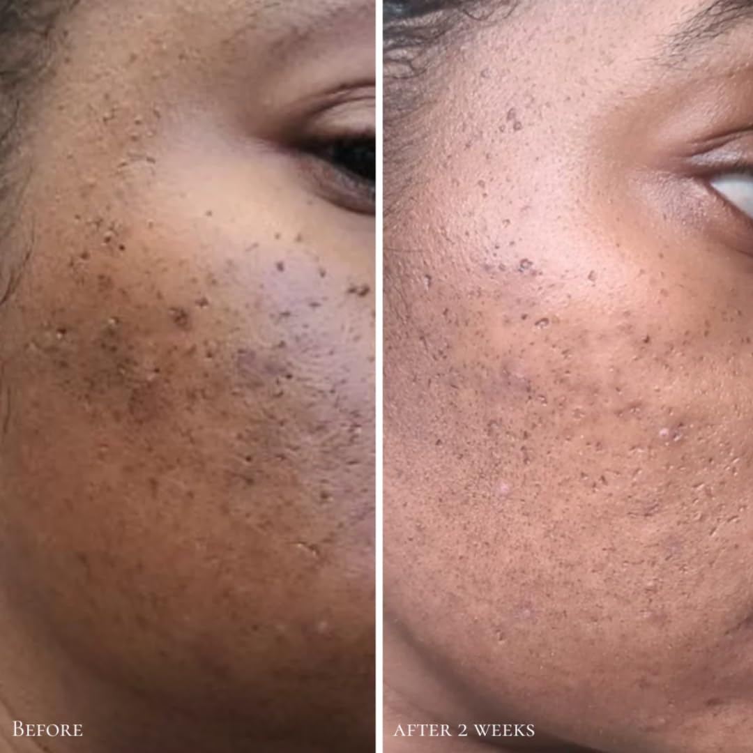 Glowbiotics Clarifying Pads box and setup in a tidy routine.