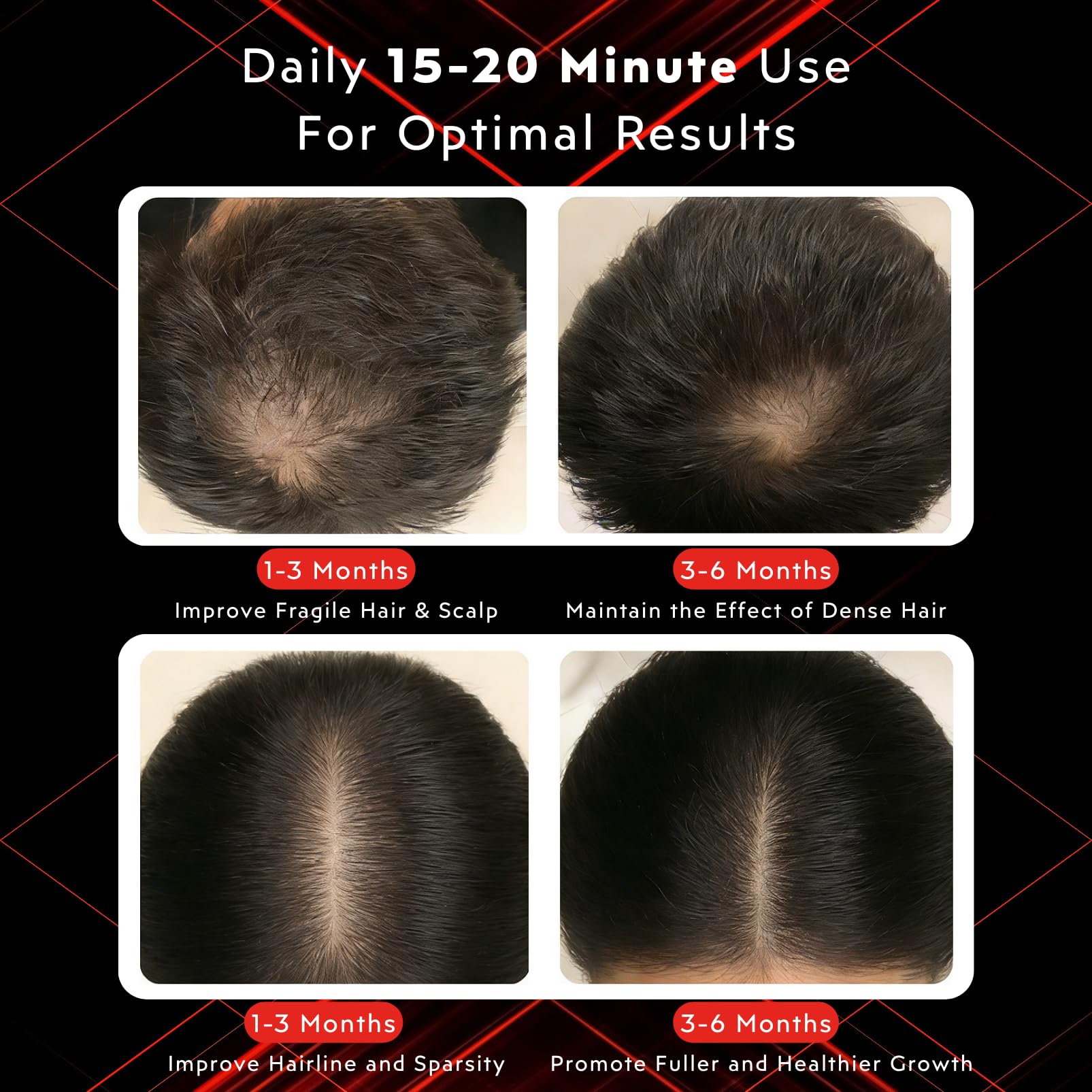 GlowFars red light cap pulse mode for dynamic scalp therapy