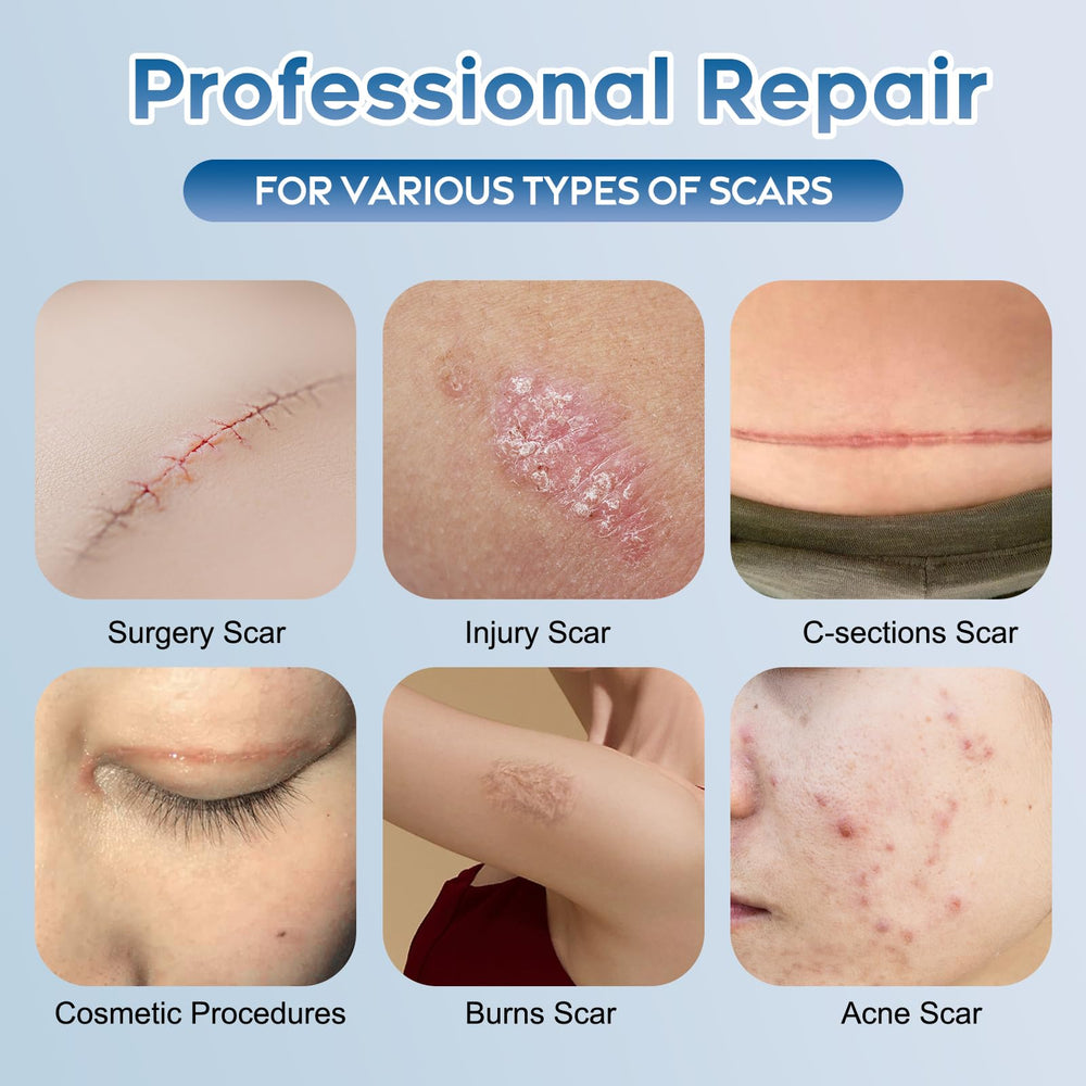 Glowor scar gel on the body to soften scar texture