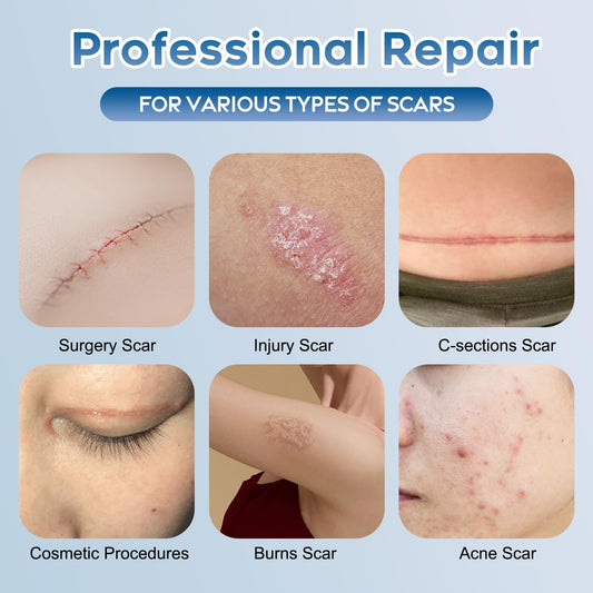 Glowor scar gel on the body to soften scar texture