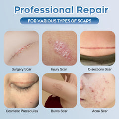 Glowor scar gel on the body to soften scar texture