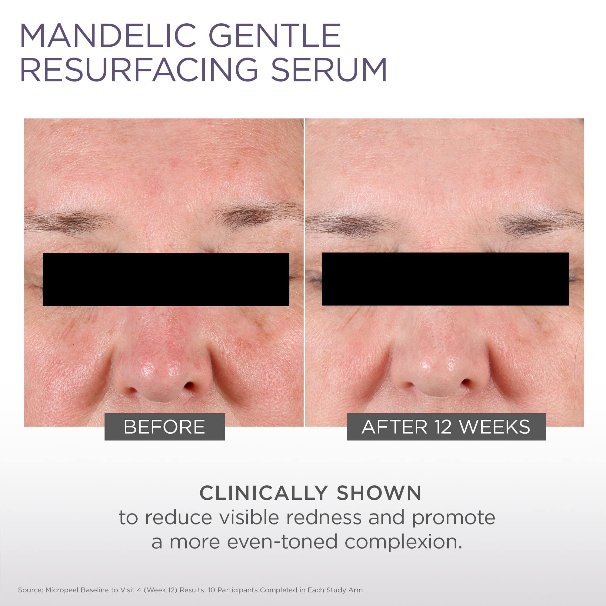 Glytone clinical results badge indicating dermatologist-recommended quality.