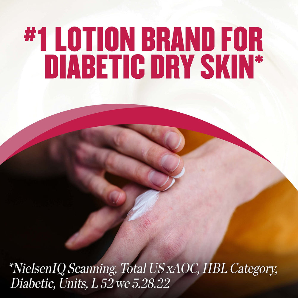 Hand applying Gold Bond Diabetics' Dry Skin Relief Hand Cream for soothing relief