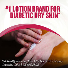 Hand applying Gold Bond Diabetics' Dry Skin Relief Hand Cream for soothing relief