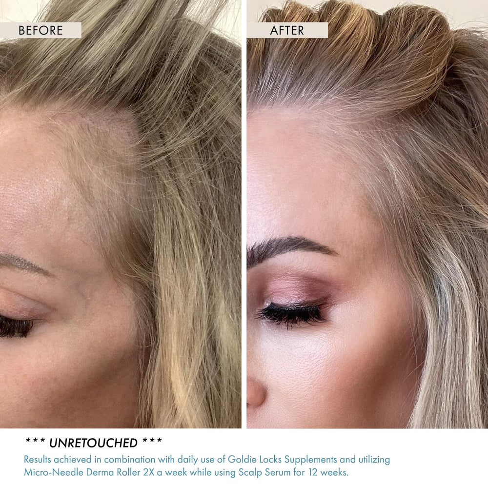 Goldie Locks Scalp Serum texture shown as lightweight, quick-absorbing formula.