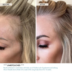 Goldie Locks Scalp Serum texture shown as lightweight, quick-absorbing formula.