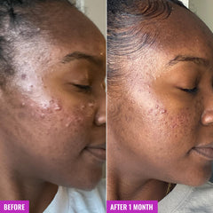 Good Molecules Acne Foaming Cleanser application shows a 20-30 second gentle massage