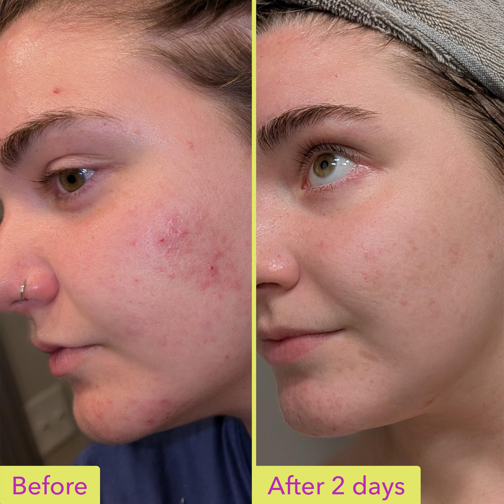 Good Molecules azelaic acid application routine image for daily AM/PM use.