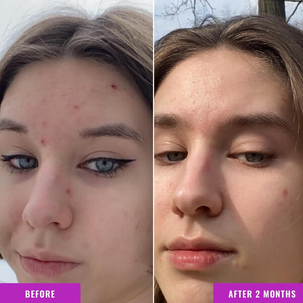 Good Molecules Niacinamide Serum box packaging highlights clean formula.