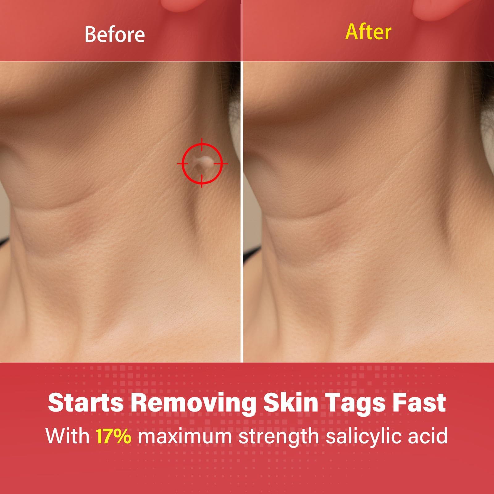 Goodnites Skin Tag Remover dotting action demonstrates precise application on a tag.