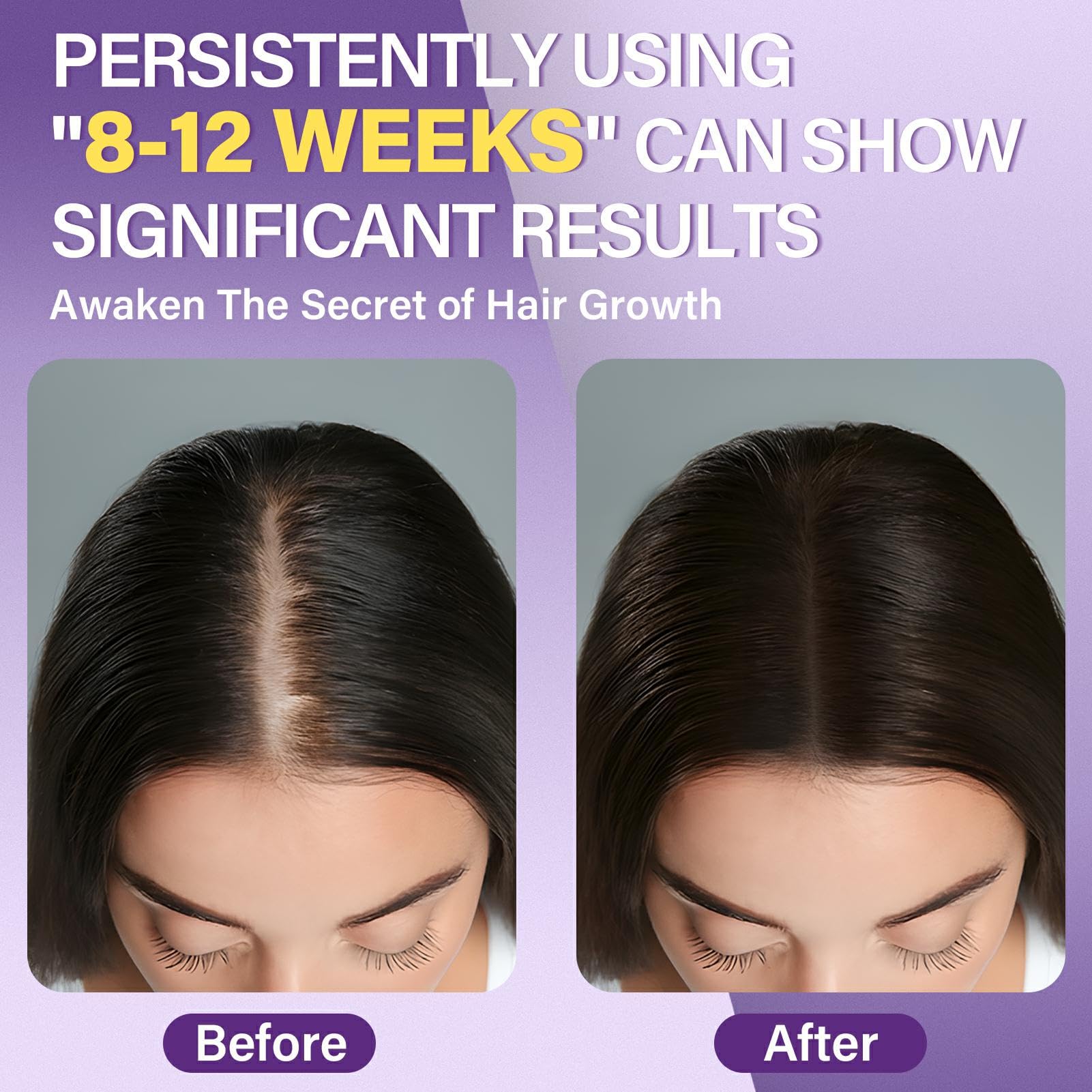 Greoay minoxidil foam pump demonstrates quick application to thinning areas