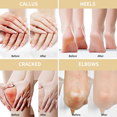 Grocerism Urea Cream for feet, hands, elbows and knees for versatile use.