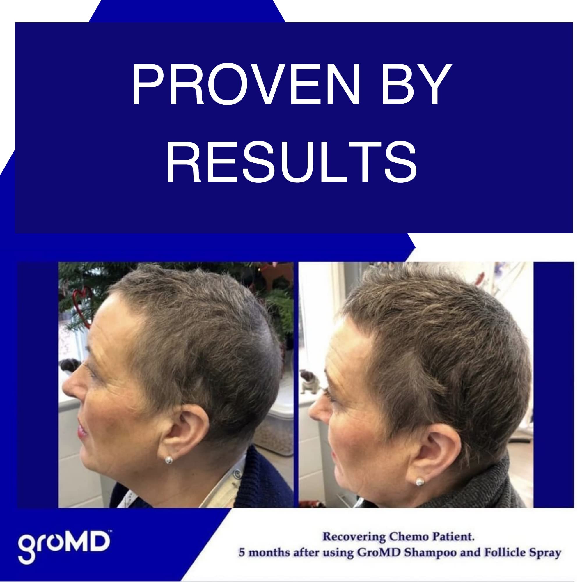 GroMD caffeine and niacinamide boost image suggests improved scalp circulation.
