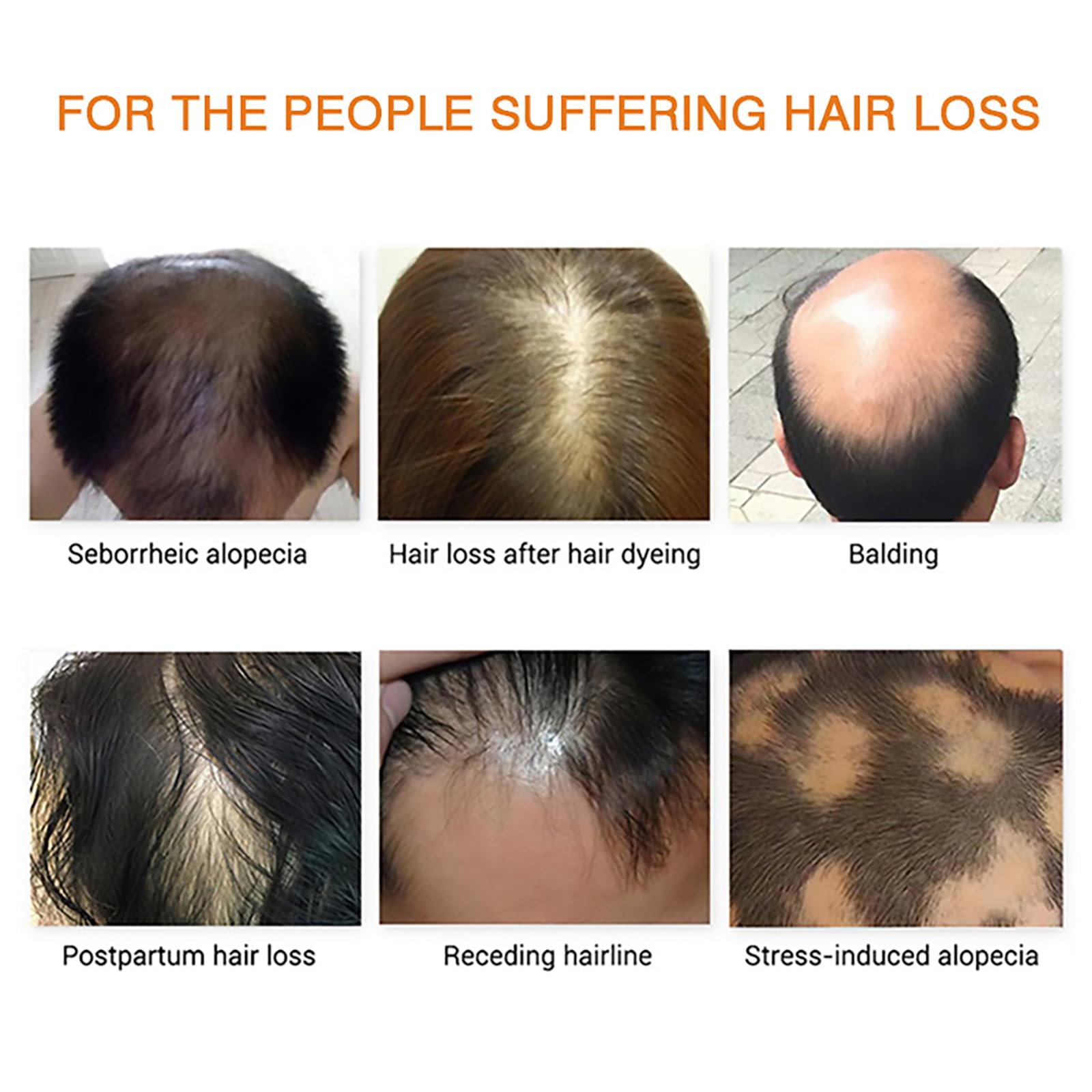 Grospe Hair Growth Essence Oil dropper emphasizes deep root hydration and revival