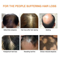 Grospe Hair Growth Essence Oil dropper emphasizes deep root hydration and revival