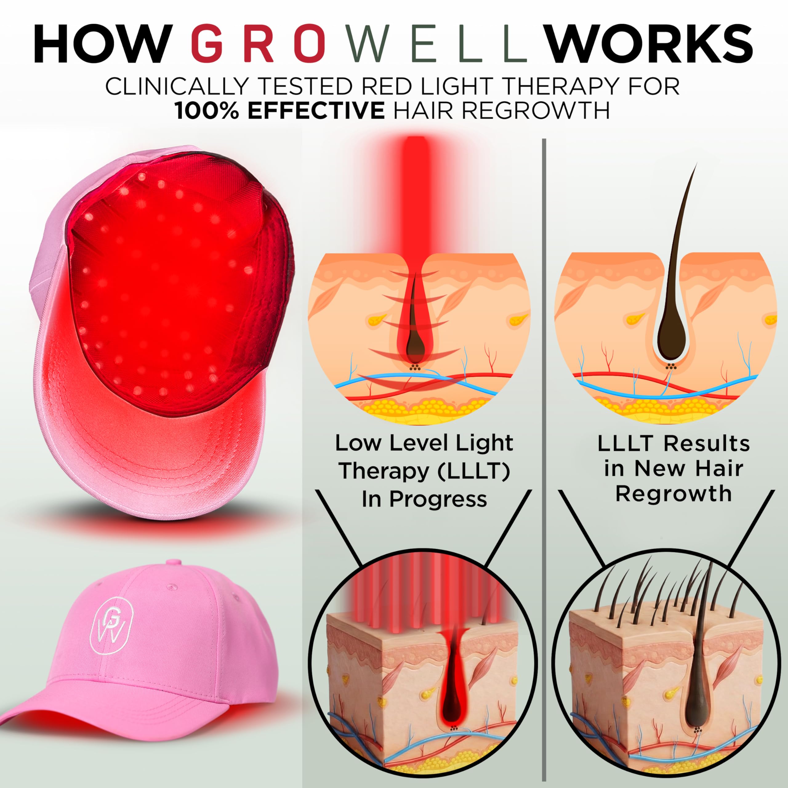 GroWell flex-panel enabling seamless energy distribution on the scalp