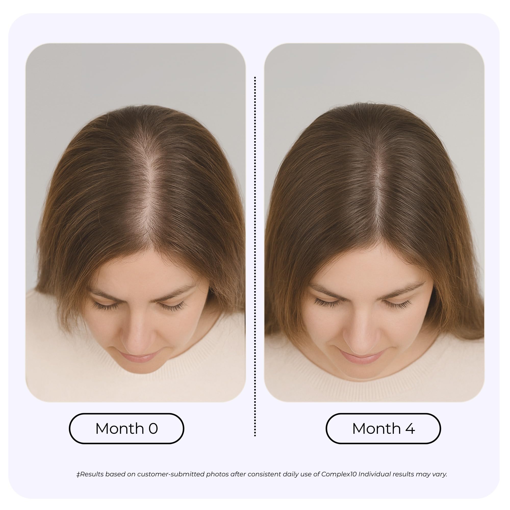 Growplex Complex10 bottle back label lists nutrients for hair vitality