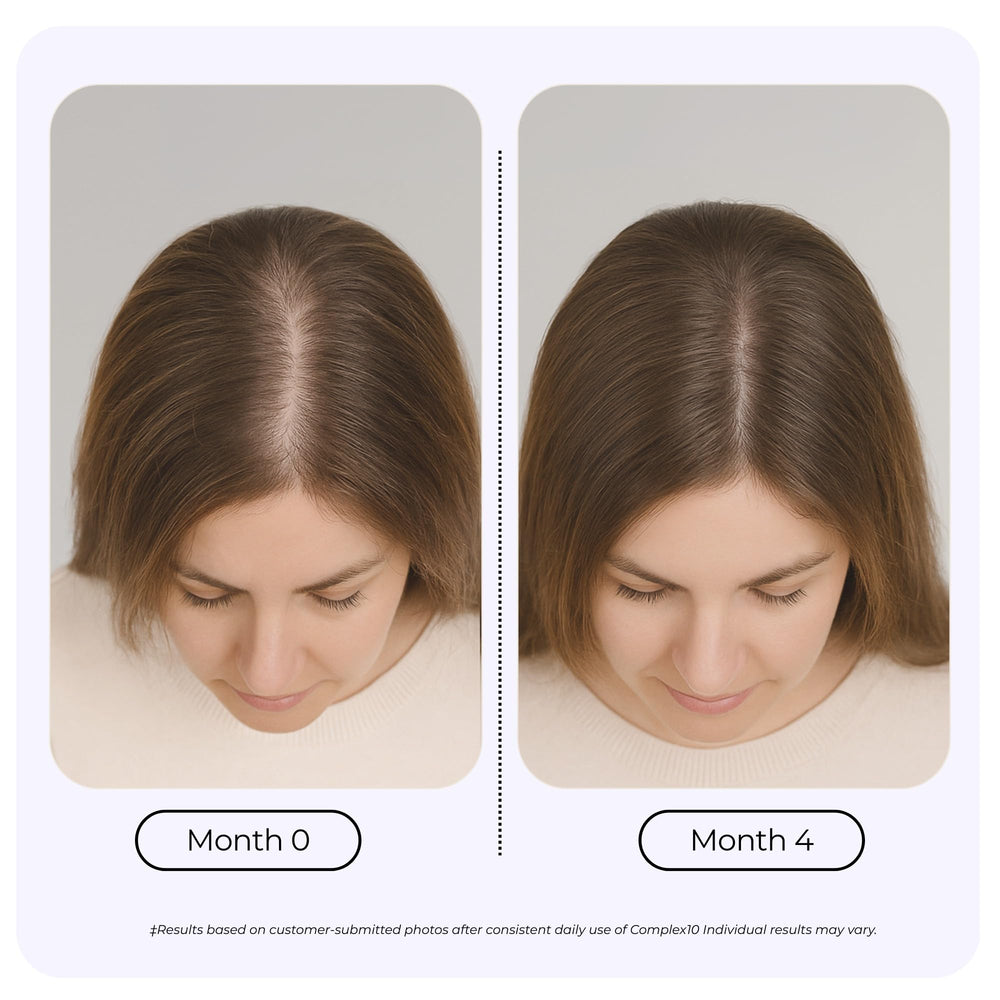 Growplex Complex10 bottle back label lists nutrients for hair vitality