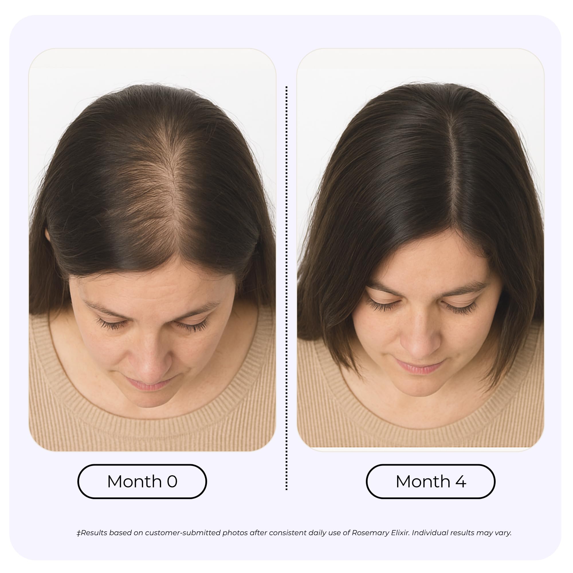 Growplex Rosemary Elixir on-scalp action delivers refreshing renewal.