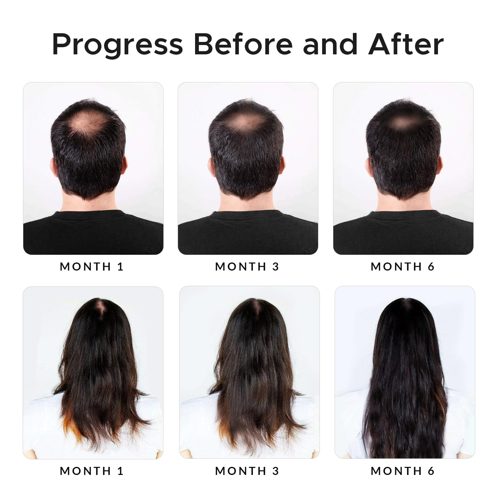 Growth Essence Minoxidil Biotin Shampoo onion extract for scalp nourishment