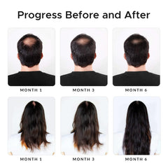 Growth Essence Minoxidil Biotin Shampoo onion extract for scalp nourishment