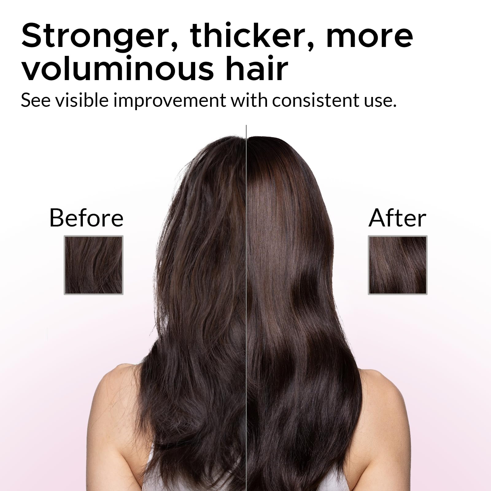 Growth Essence Minoxidil Shampoo bottle cap close-up hints at easy daily dosing.