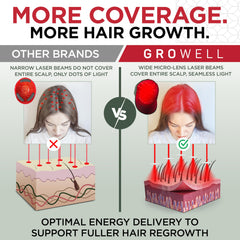 GroWell seamless scalp coverage ensures uniform energy delivery.