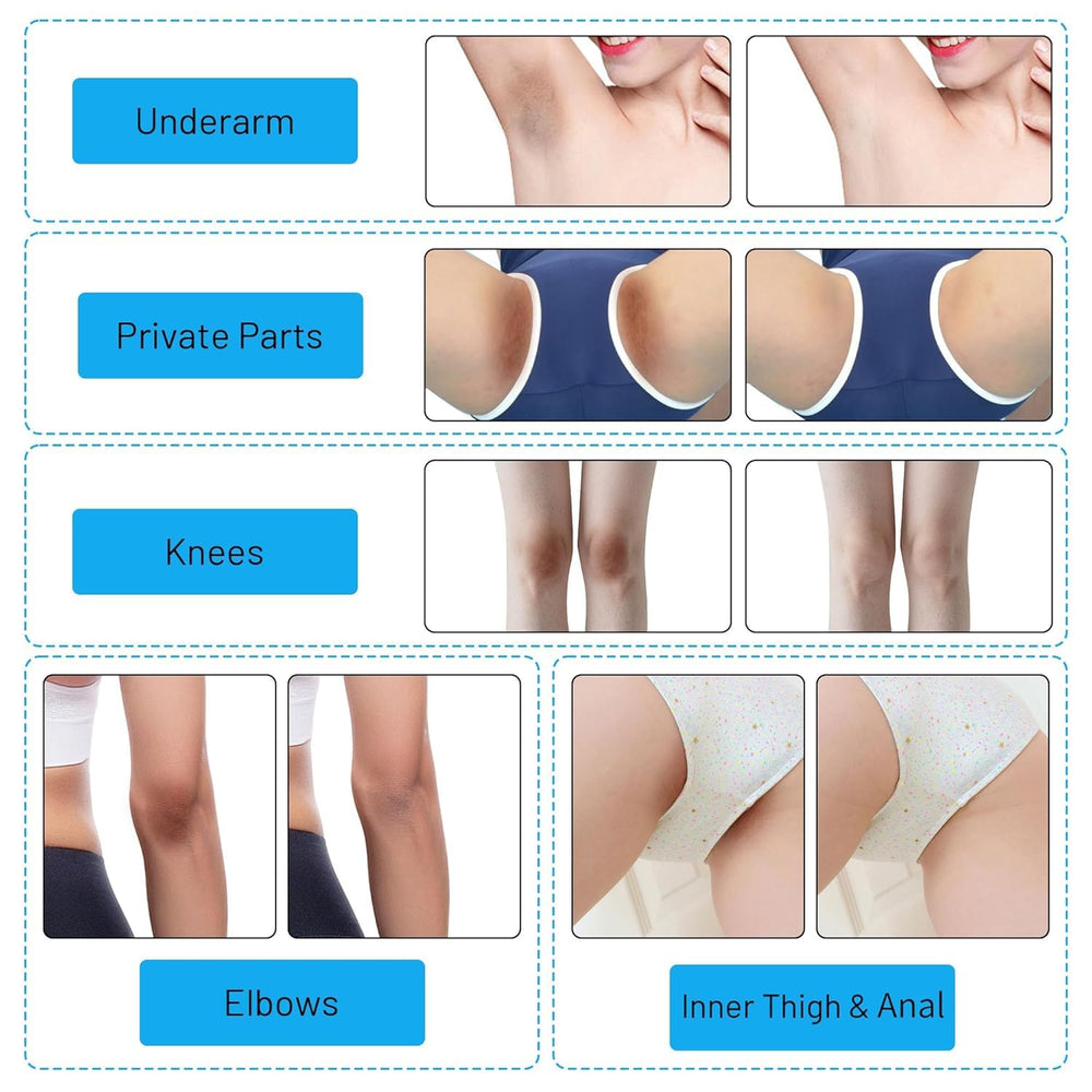 Gukei Skin Lightening Cream Gel armpit care for toned look.