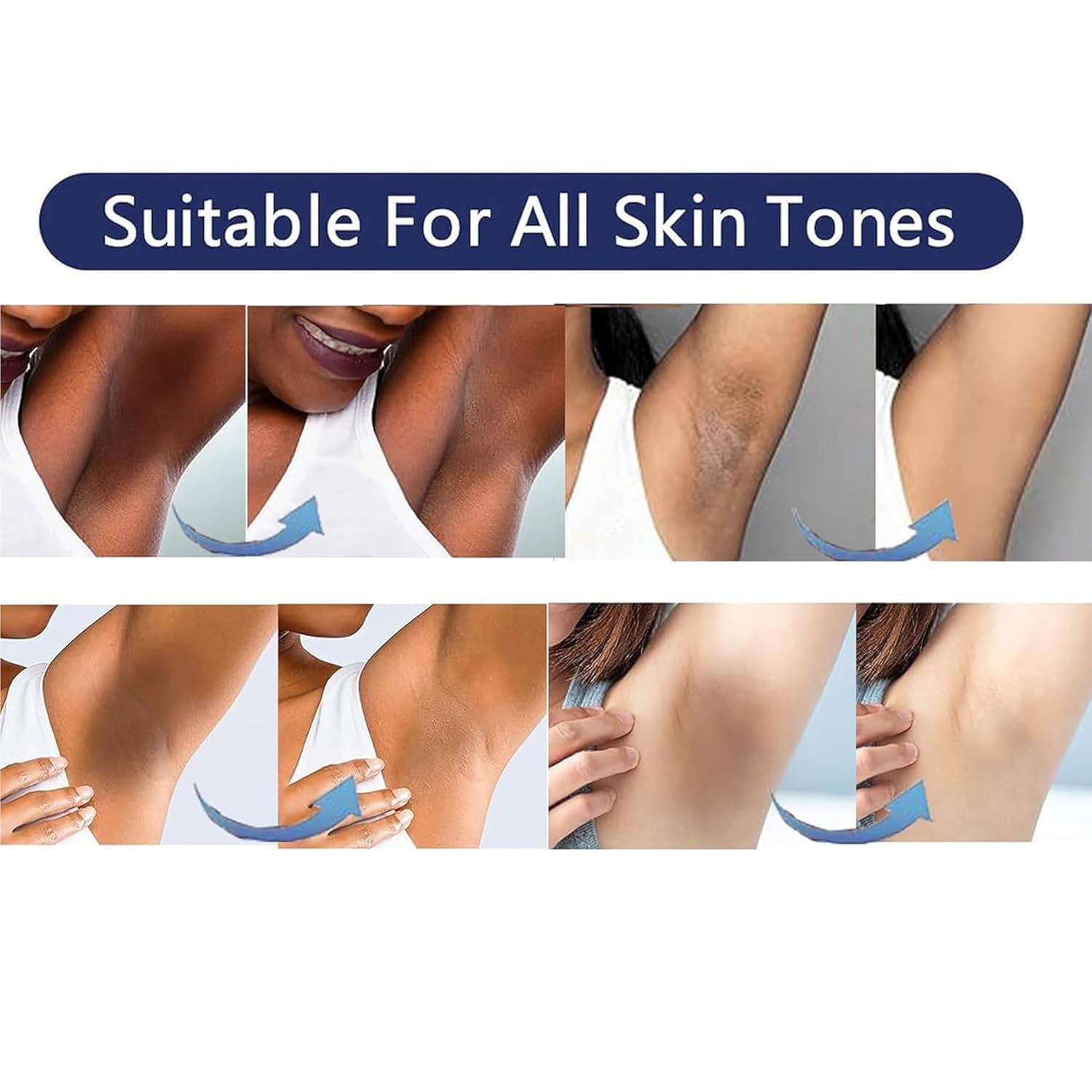 Gukei Skin Lightening Cream Gel on knees and elbows for even color.