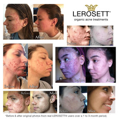 Close-up of aloe and lemon visuals with LEROSETT for balance