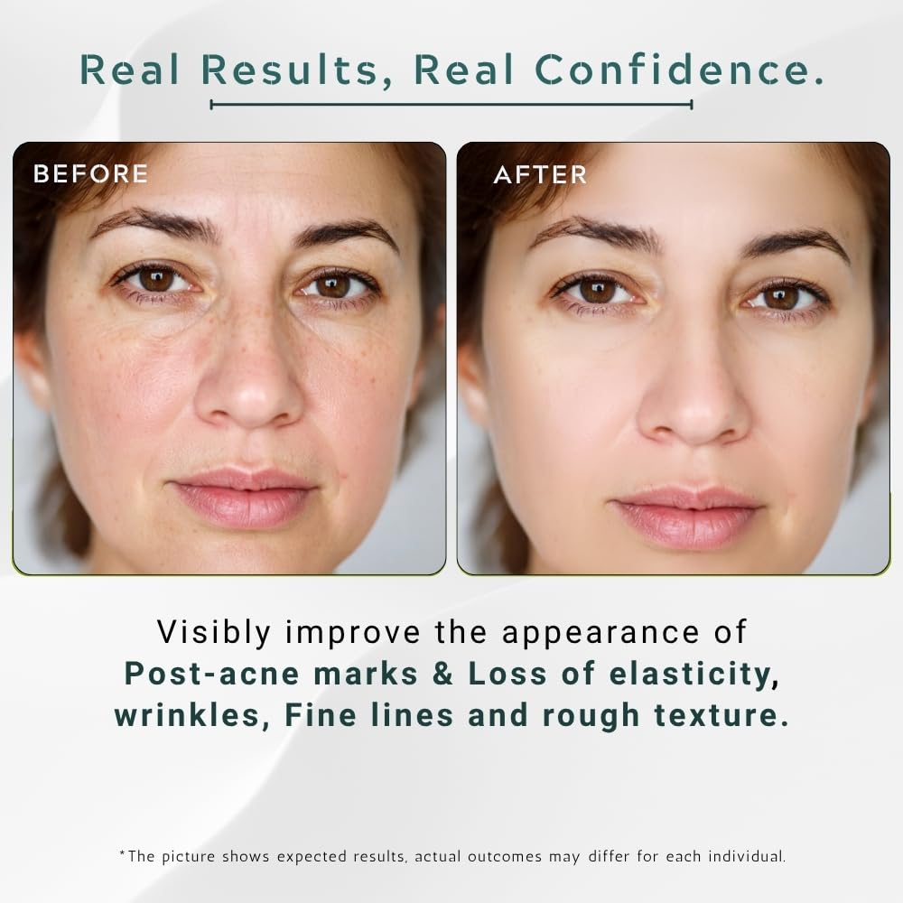 Gutaderme hyaluronic acid 10 percent concept emphasizing deep hydration.
