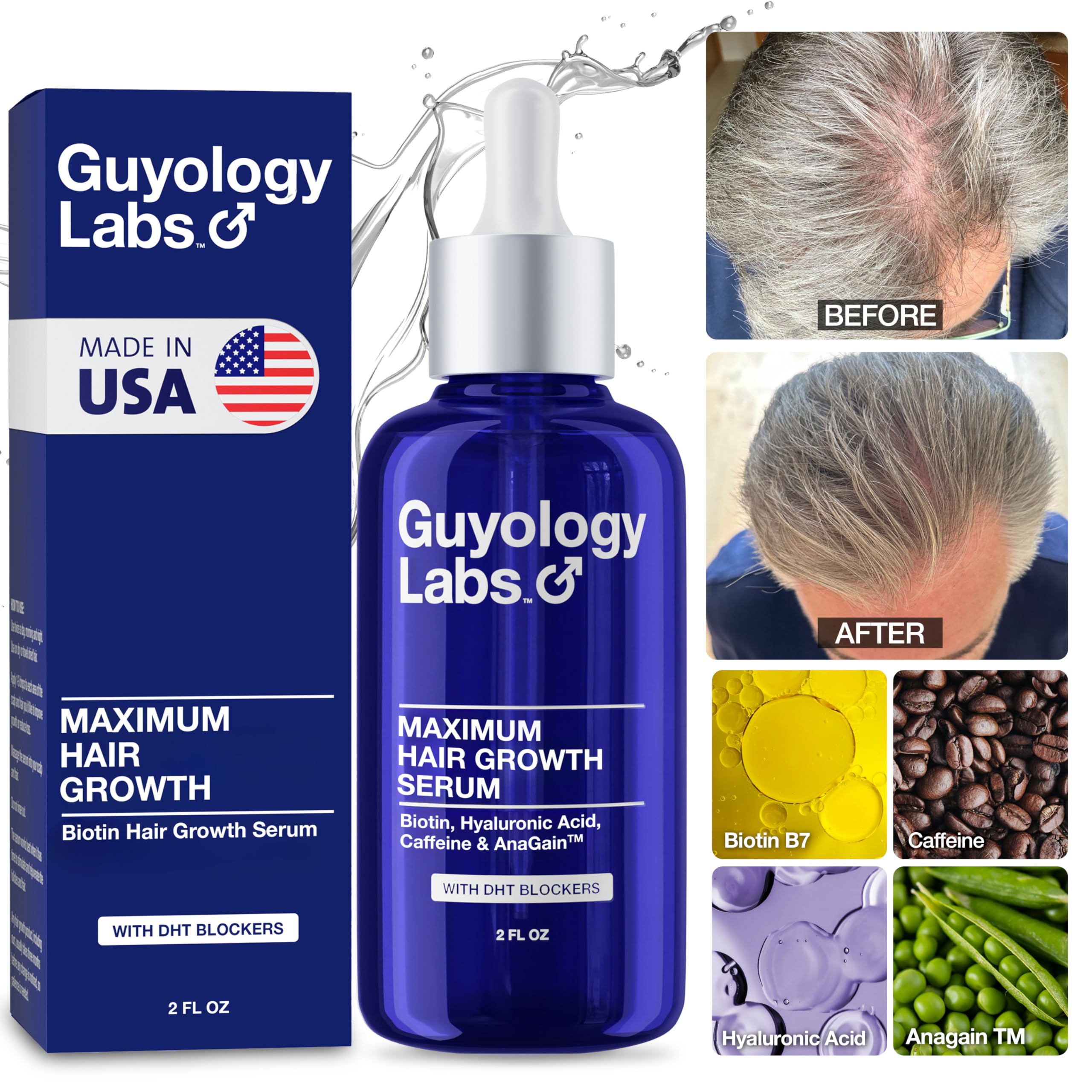 Guyology Labs Hair Growth Serum being applied twice daily on scalp