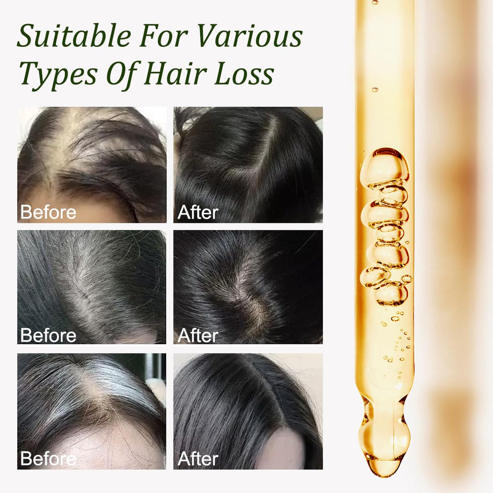 Gypsophila Batana Oil damaged-hair repair showing rich nourishment for dry, brittle strands.