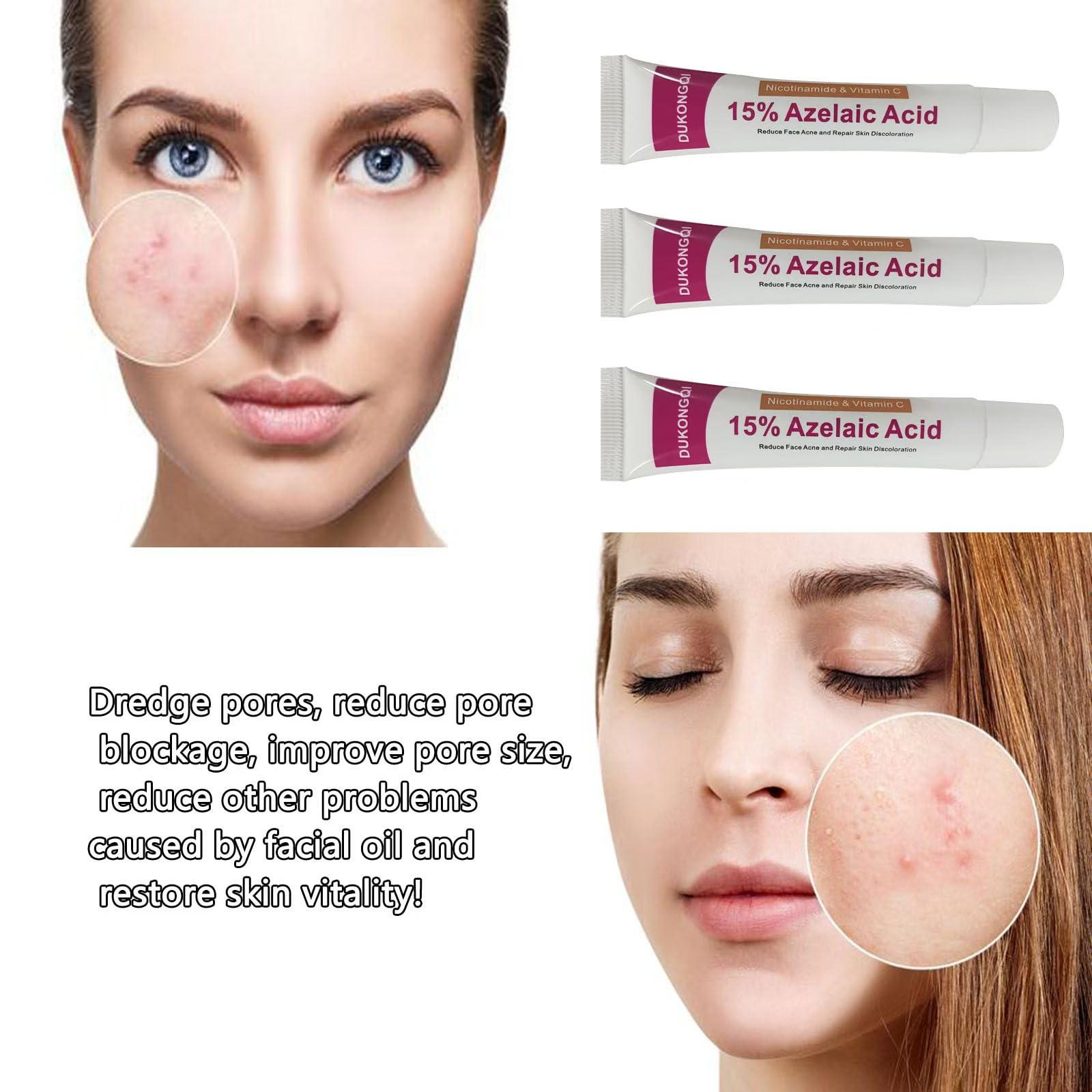 gzchaox azelaic acid cream with daily use benefits on skin