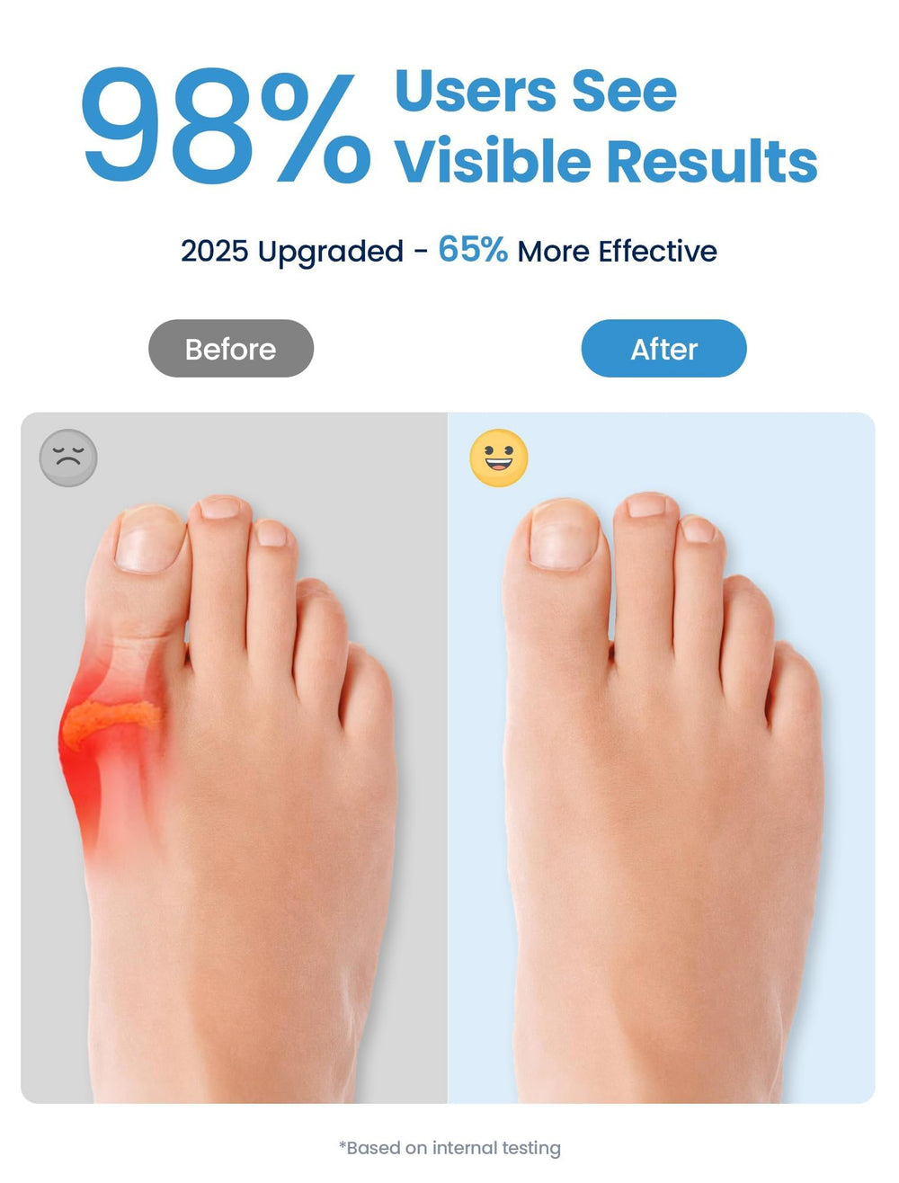 Habioer toe separators with ergonomic fit reduce friction between big toe and second toe.