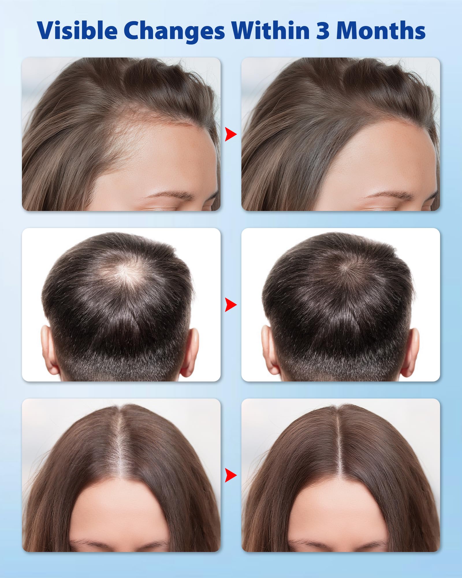 HACIRJNG Suitable for all hair types, root nourishment