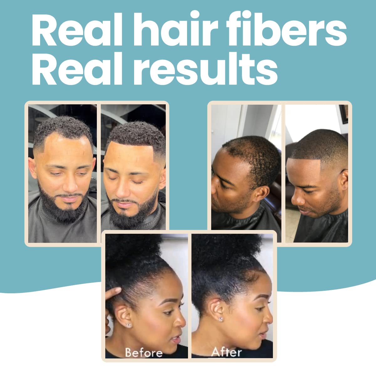 Hair Illusion application on temple area demonstrating thinning concealment.