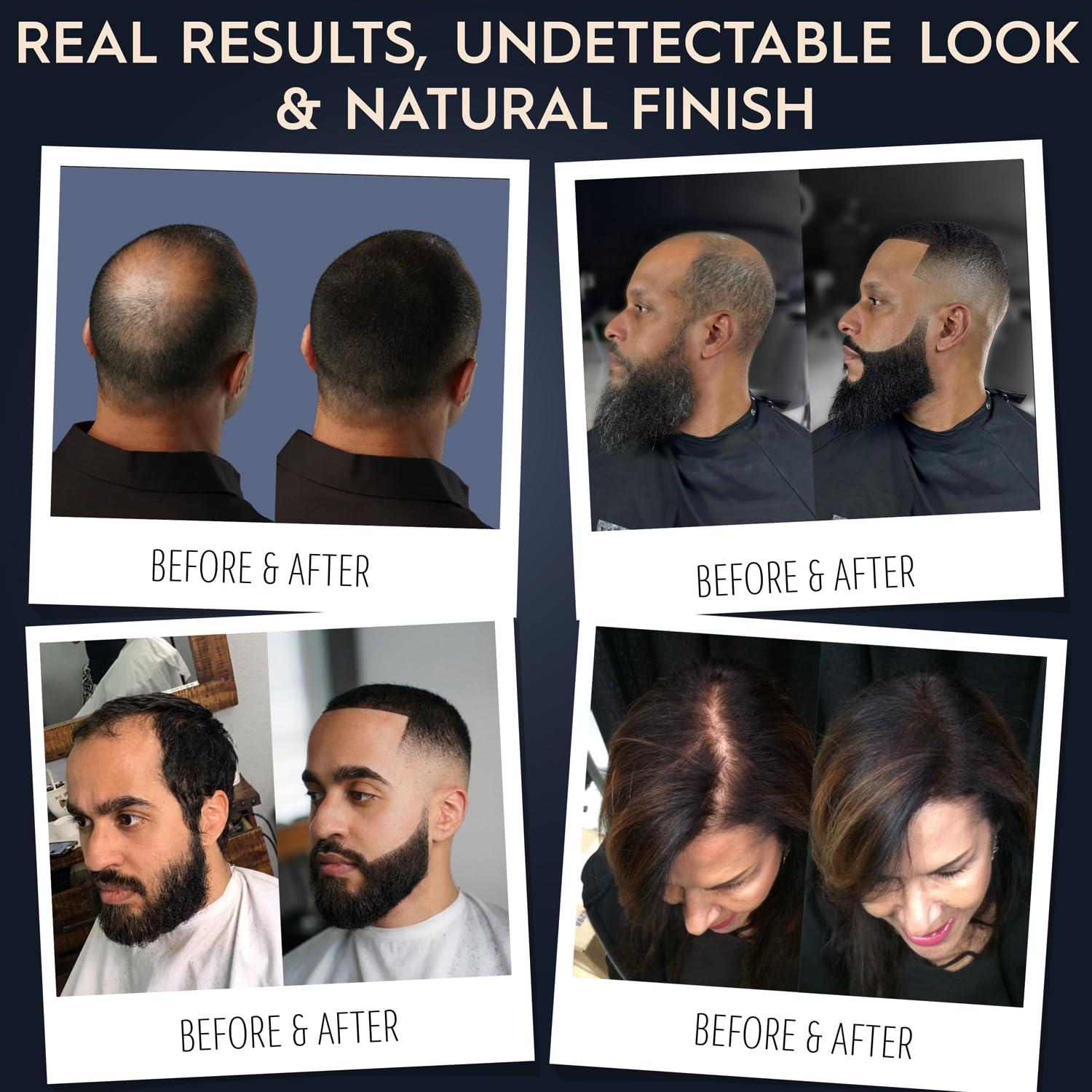 Hair Illusion thinning-areas coverage for a discreet improvement