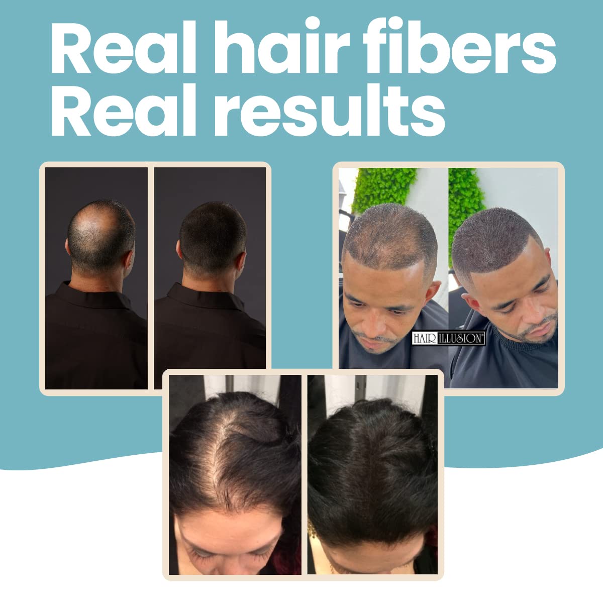 Hair Illusion thinning crown coverage in a real-life scenario.