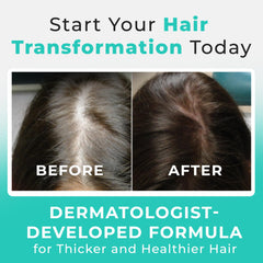 Hair Plus MD collagen and vitamins blend promotes hair wellness and vitality