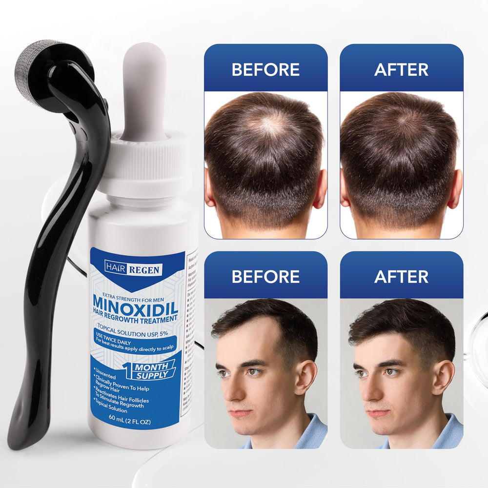 Hair Regen bottle label close-up showing dosage and branding.