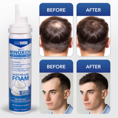 Hair Regen Minoxidil Foam smooth texture for comfortable daily use