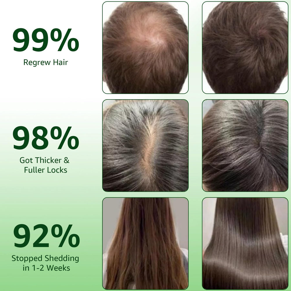 Hair Regrowth System ginseng extract close-up signals vitality and fuller-looking hair.