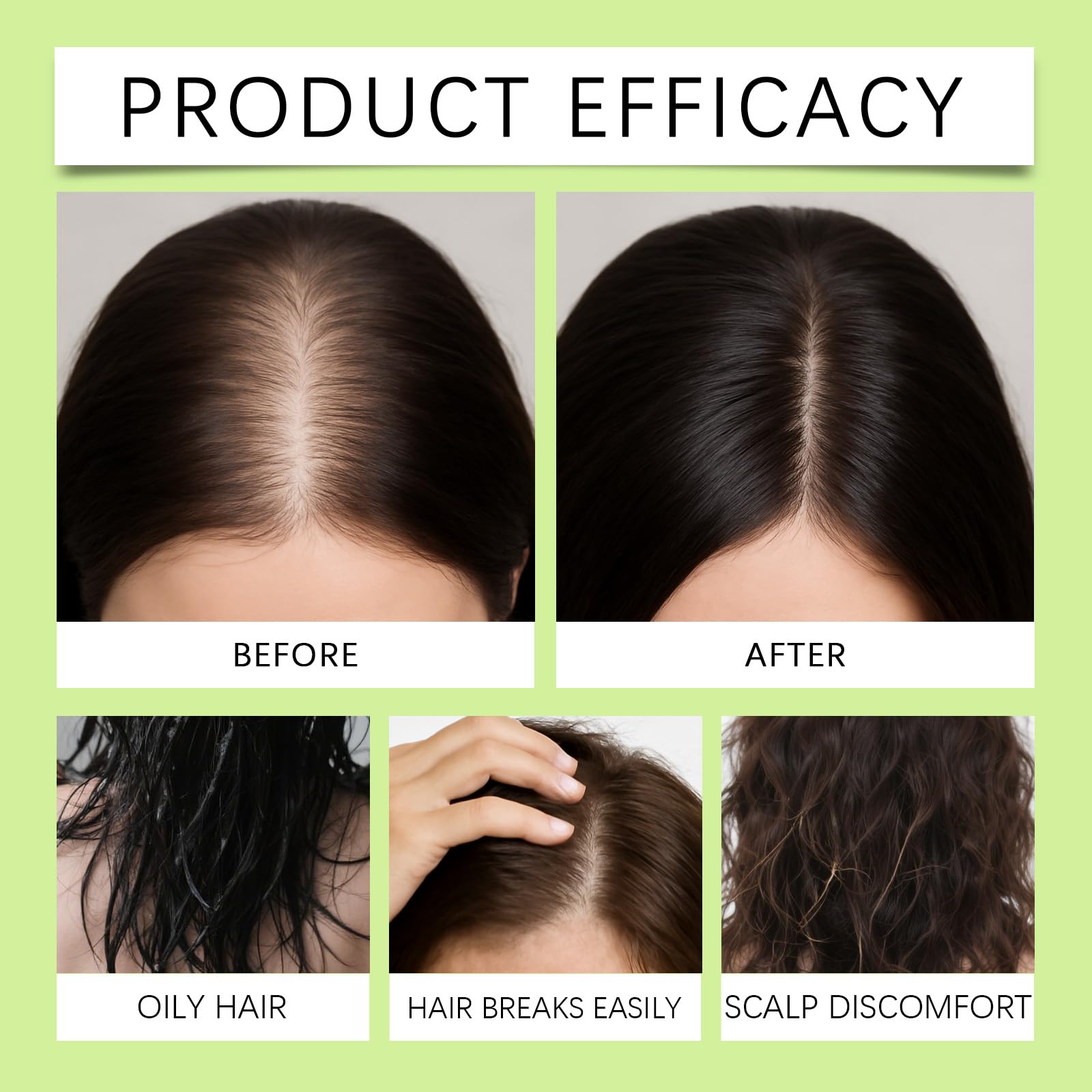 Hair Regrowth System peppermint oil scent adds a refreshing feel during application.