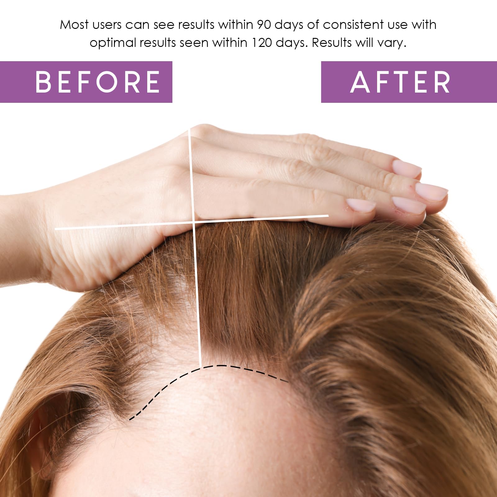Hair to Stay tea tree scalp cleanse showing purifying action