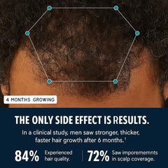 Hairfol ingredients-collagen: collagen promotes resilient hair and balanced scalp texture.