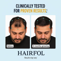Hairfol ingredients-saw-palmetto: natural extract supporting follicle health in men.