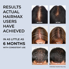 HairMax Laser Band 41 back view highlighting ergonomic, cord-free operation.